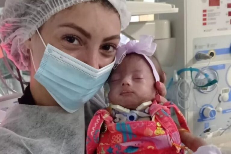 “Médicos dizem que minha filha é incompatível com a vida” afirma mãe de bebê com síndrome raríssima – Pais