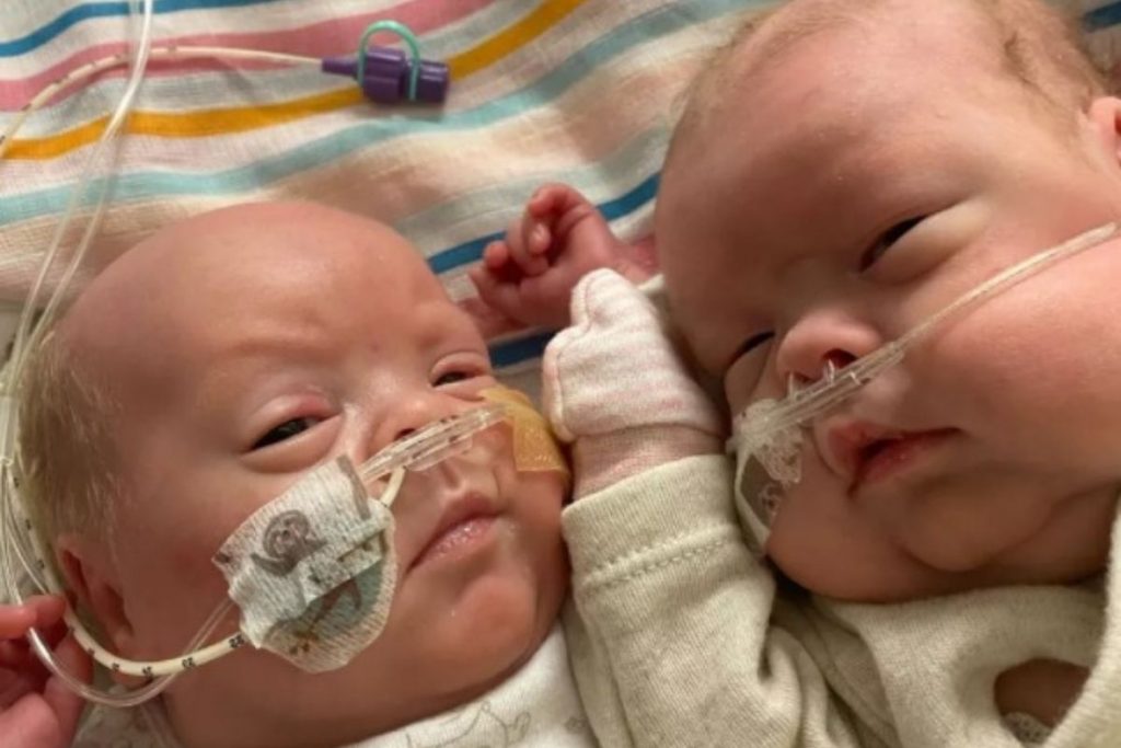 Gêmeos que nasceram com 5 meses vão para casa após passarem por 6 cirurgias e 25 transfusões de sangue – Pais