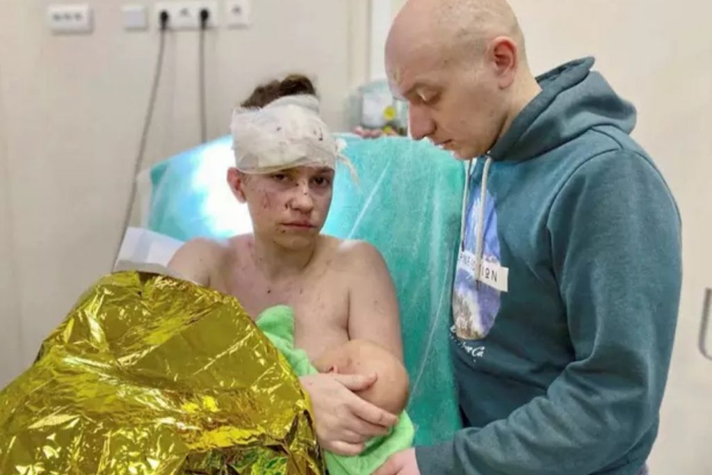 Mãe ucraniana passa por cirurgia após usar o corpo para proteger bebê de 6 meses em explosão – Pais